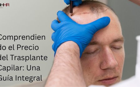 Comprendiendo el Precio del Trasplante Capilar: Una Guía Integral