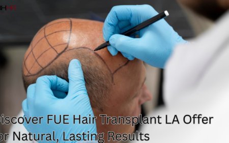 Discover FUE Hair Transplant LA Offer for Natural, Lasting Results