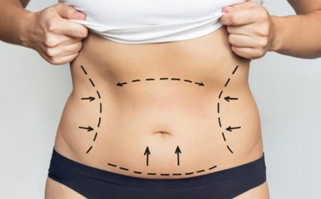 Meet the Best Liposuction Doctors in Dubai for Ideal Contours