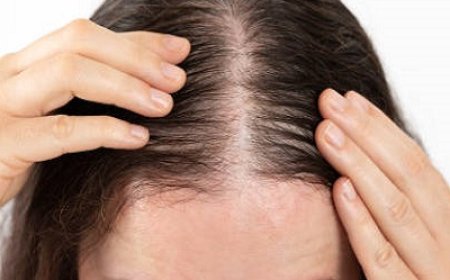 Exosome Therapy in Islamabad: A Breakthrough in Regenerative Medicine