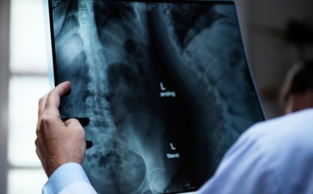 X-Ray Imaging for Seniors in Dubai: Monitoring Bone Health and Mobility