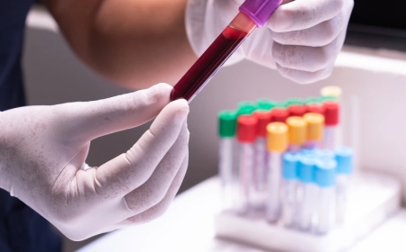 Latin America In-vitro Diagnostics Market Size & Forecast 2034