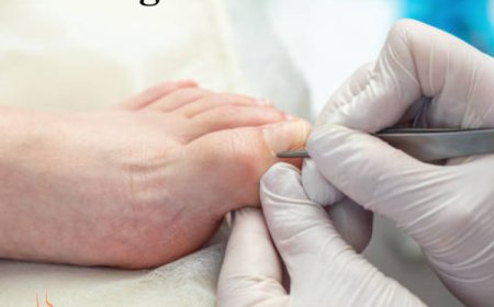 Emergency Ingrown Toenail Dr Near Me – Open Now, Nearby Clinic