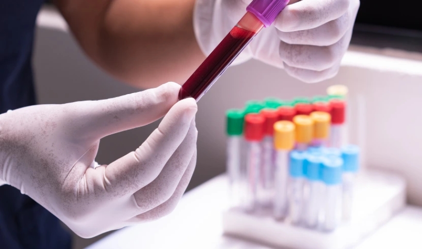 Latin America In-vitro Diagnostics Market Size & Forecast 2034